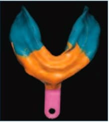 Aquasil Massad Final Maxillary Impression Aquasil Massad Final Maxillary Impression