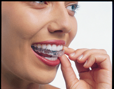 Take home teeth whitening tray