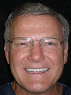 Dr. Ron Lumineers case after