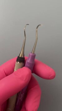 Scaler Two curved hand-scaling instruments used to remove tartar from teeth